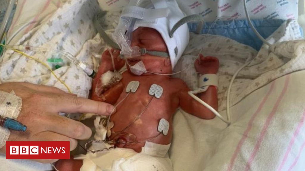 Neonatal pay: 'I used to be cheated out of time with my untimely child’