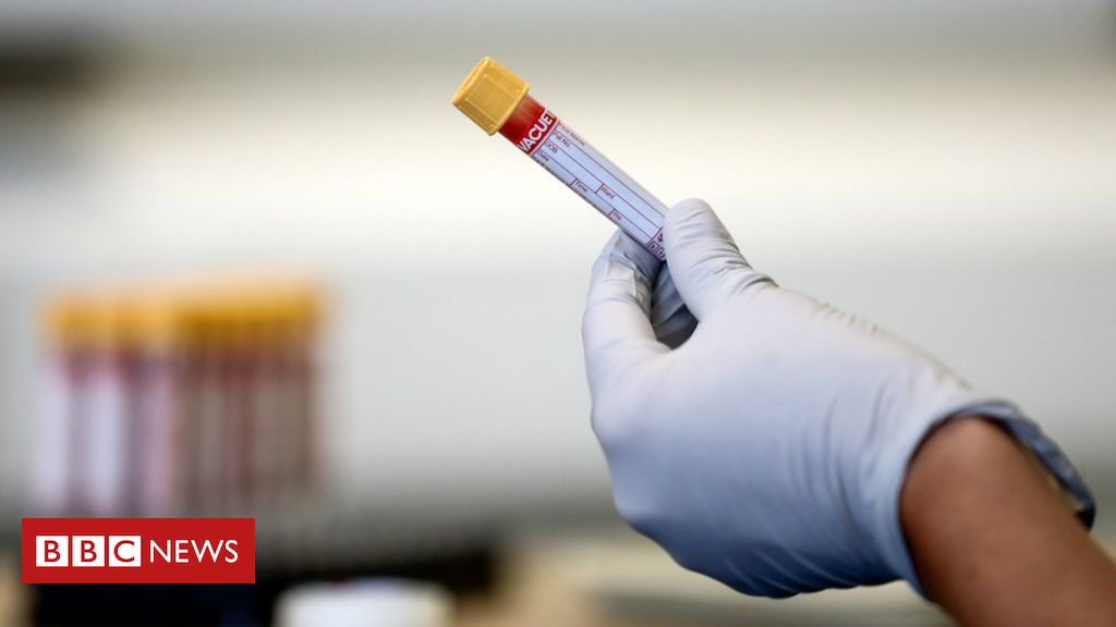 Coronavirus: Medical regulator investigates £30m Covid contract agency