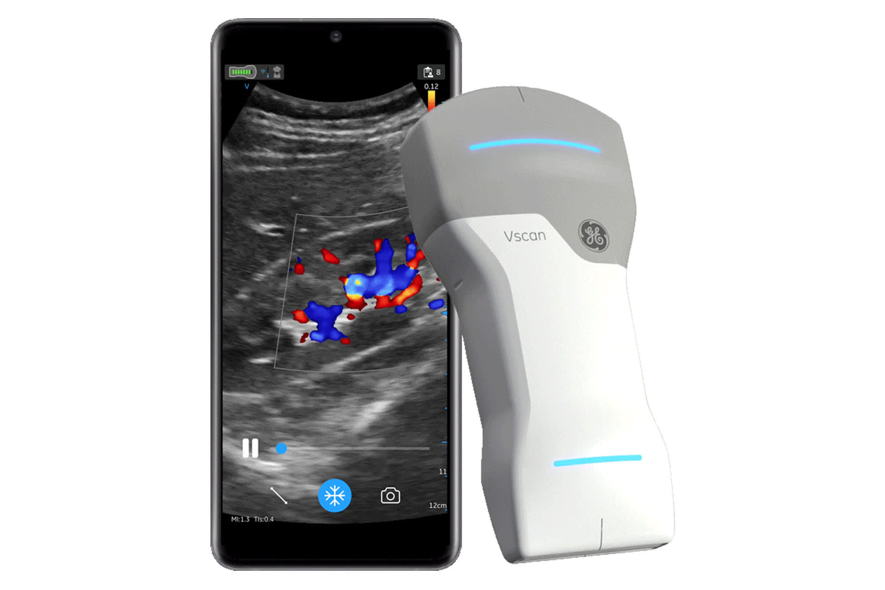 GE Healthcare launches new wi-fi hand-held ultrasound as CEO eyes rising market