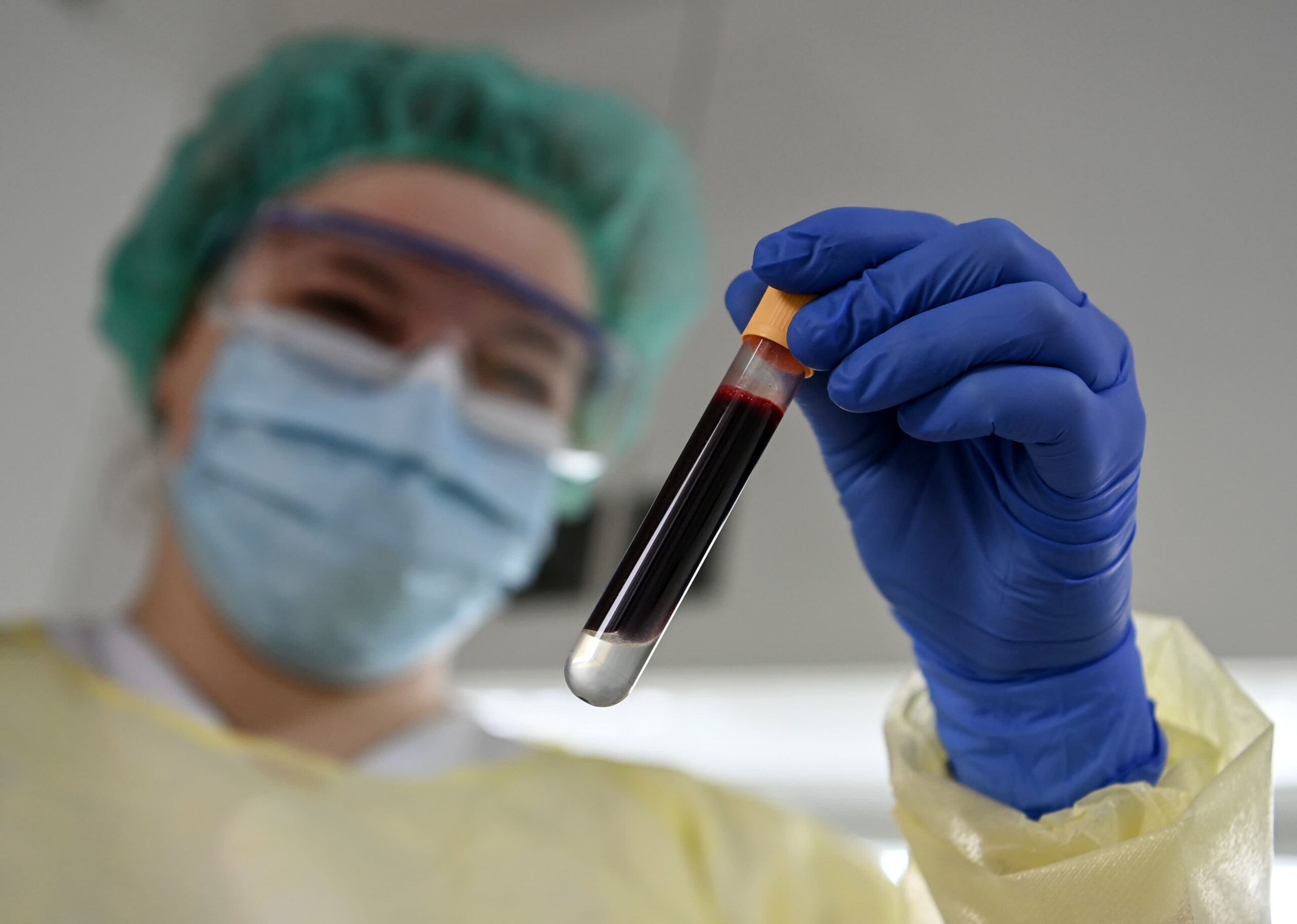 Theranos is historical past, however massive blood testing breakthroughs are coming