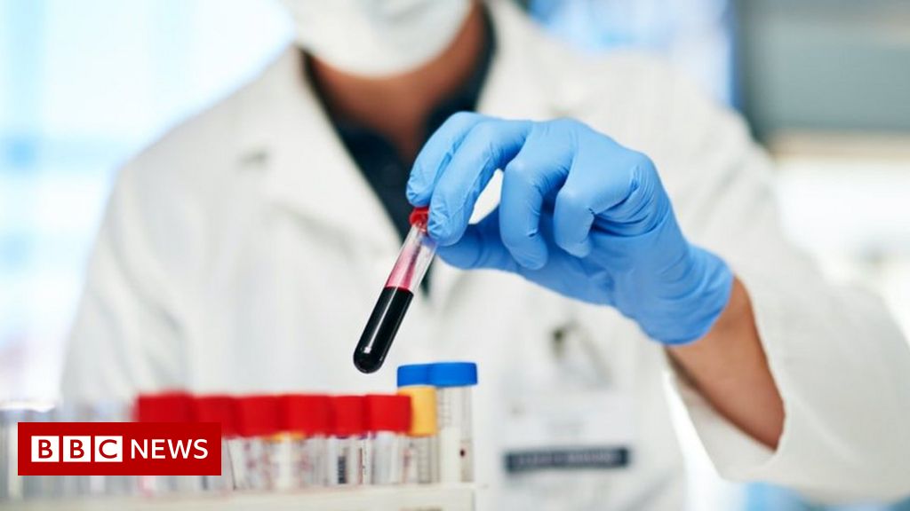 NHS blood check tube scarcity set to worsen
