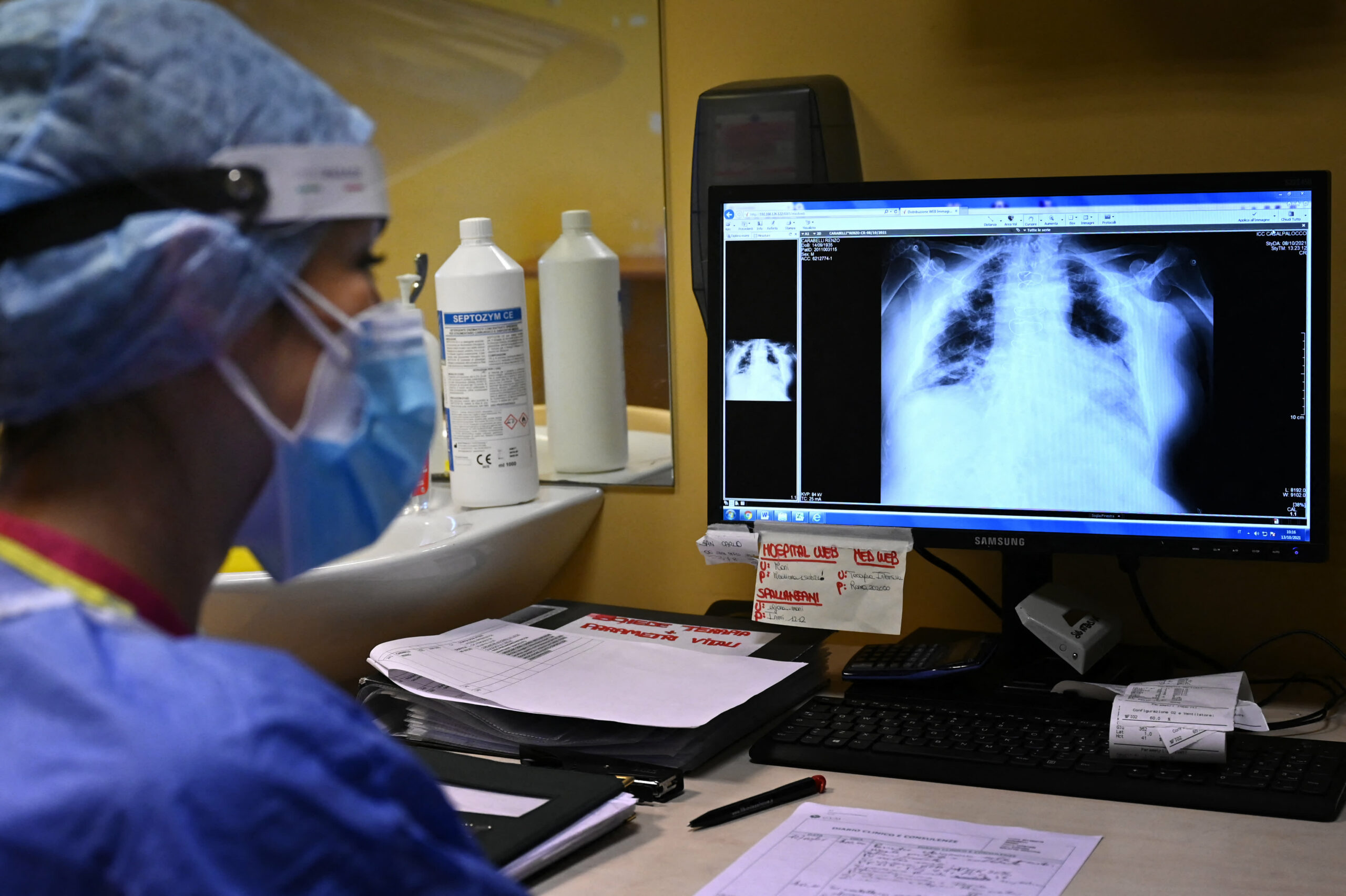 Omicron lung infection less severe, replicates faster than delta in human airways: Study