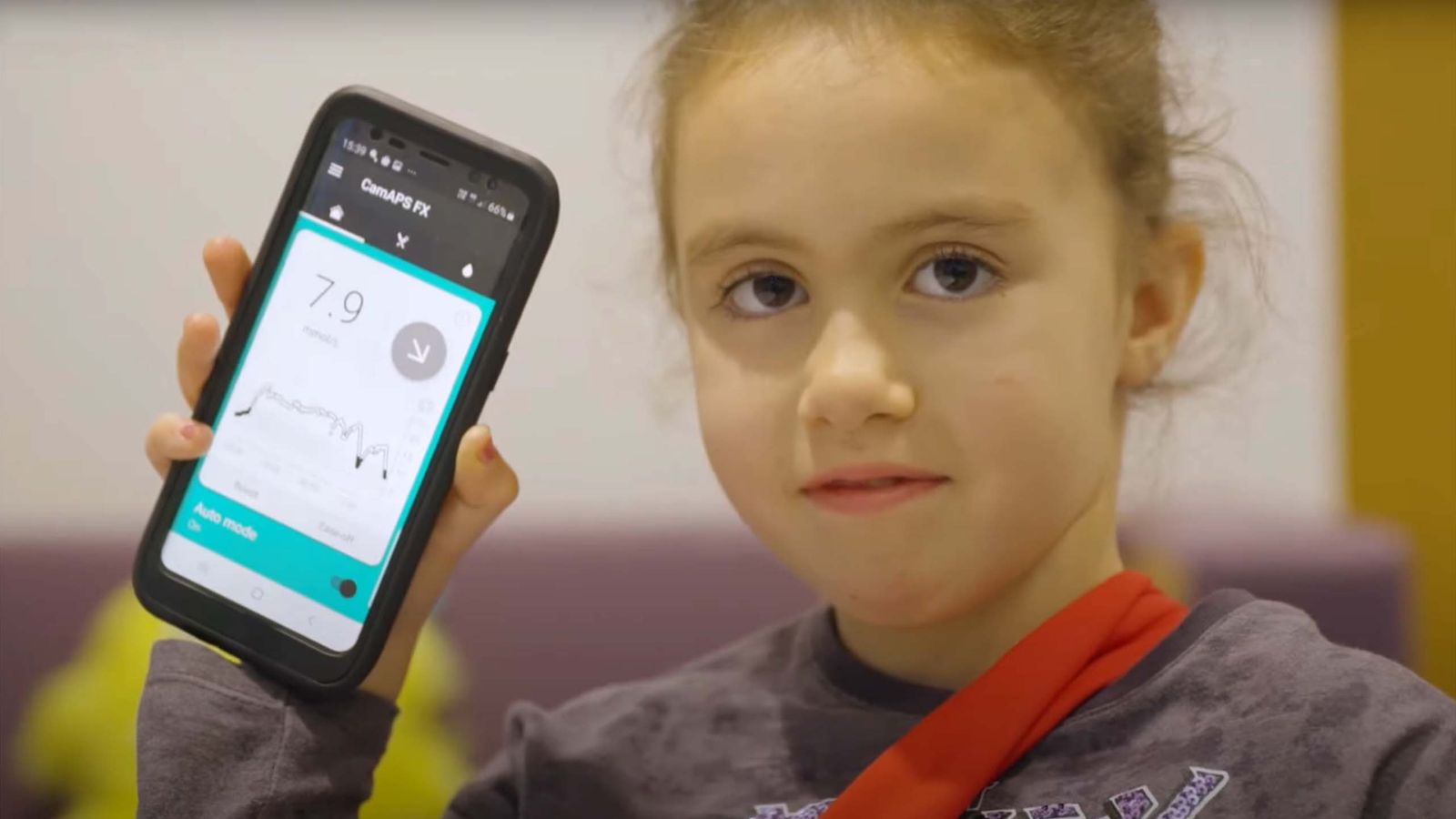 Type 1 diabetes: Artificial pancreas ‘life-changing’ for very young children, experts say | Science & Tech News