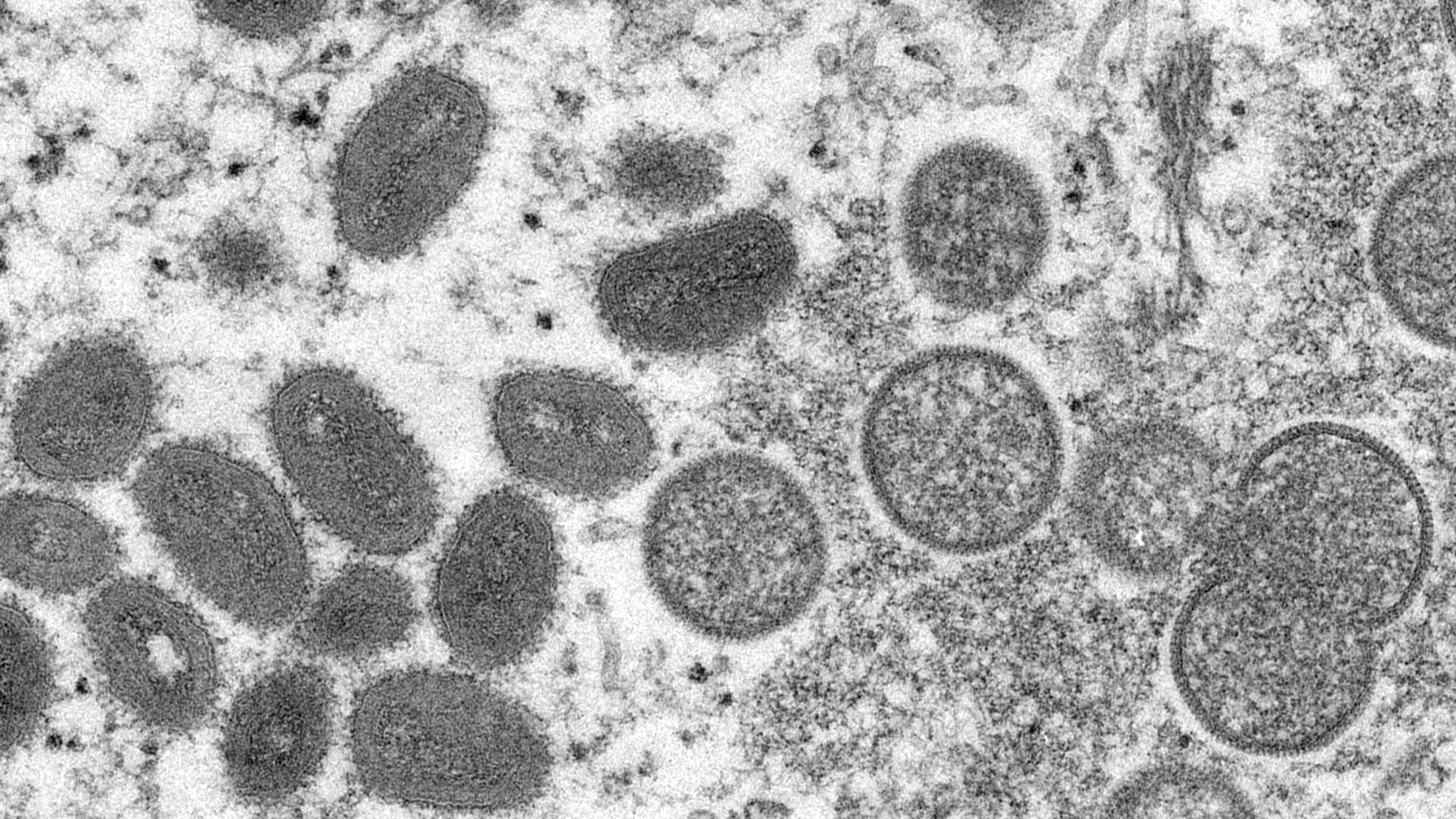 World Health Organization confirms 80 cases of monkeypox with outbreaks in 11 countries