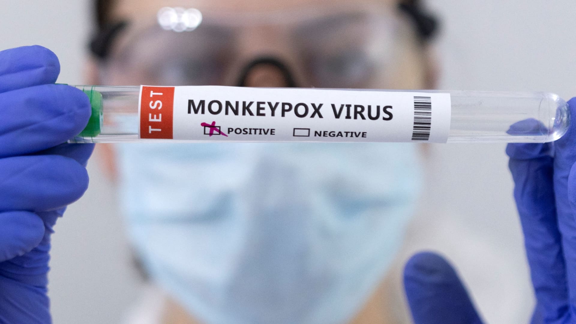 How to protect yourself against monkeypox, what to do if you catch it