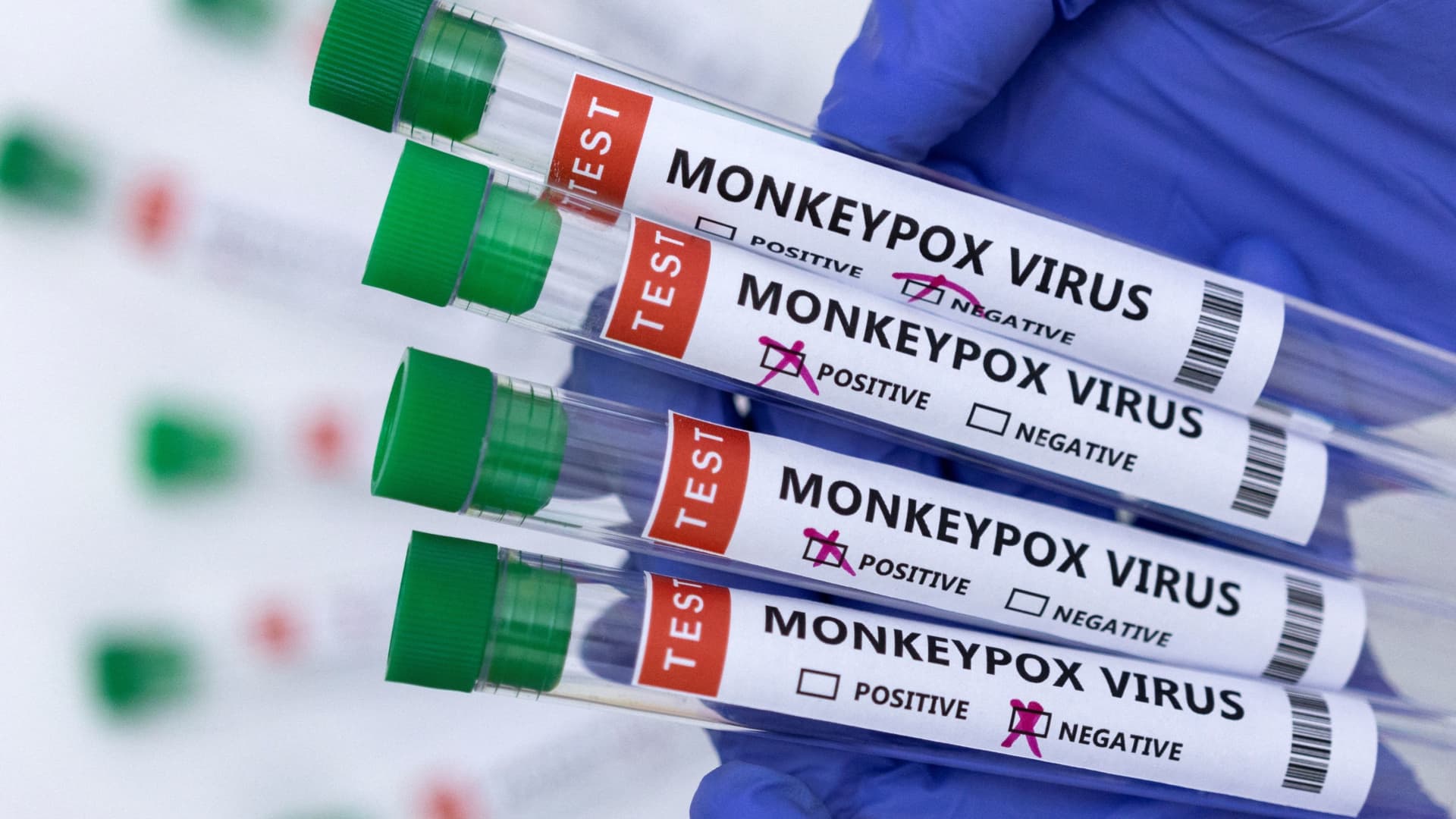 CDC raises monkeypox alert as global cases surpass 1,000