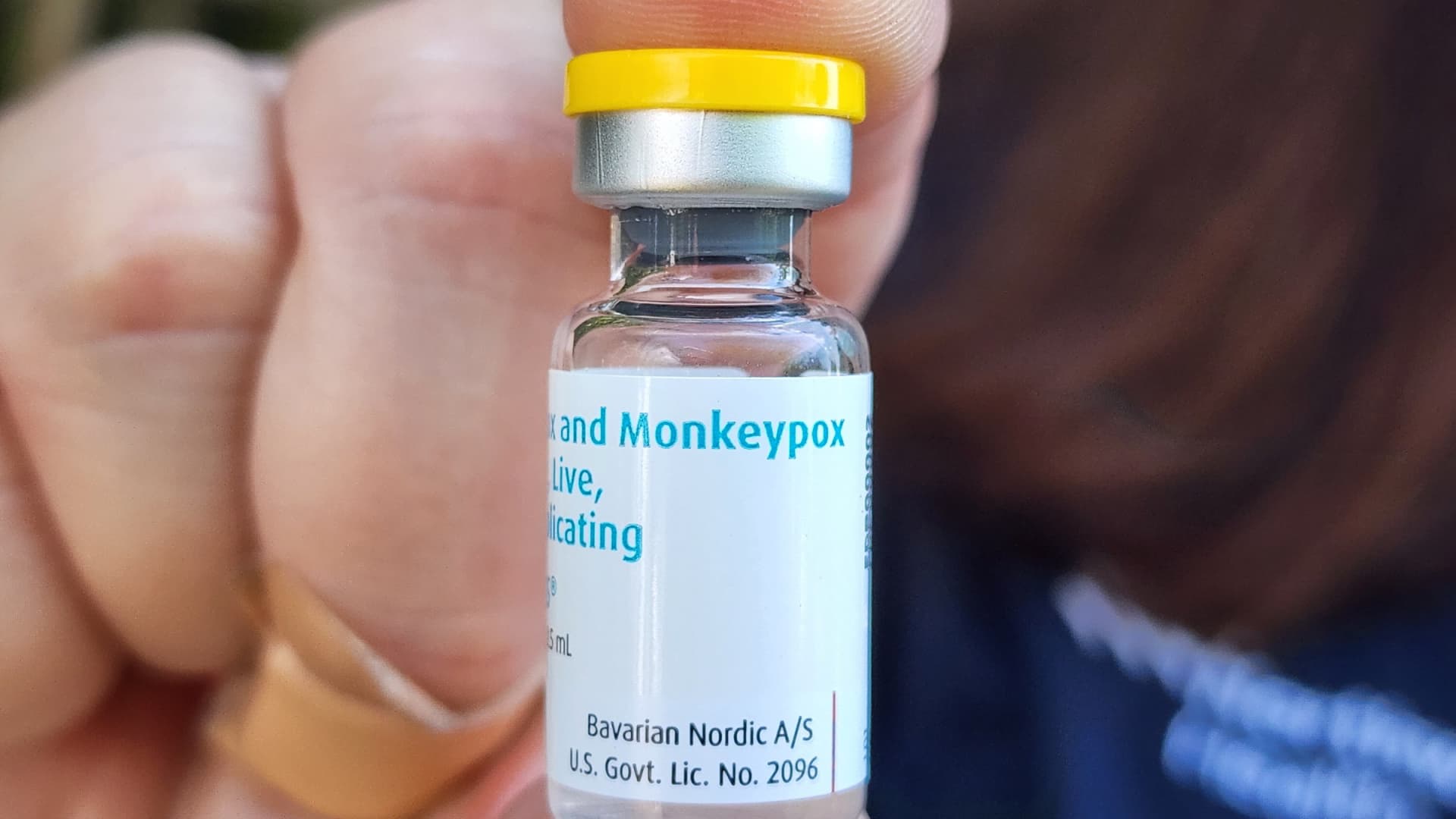 Ohio reports third U.S. death of person with monkeypox
